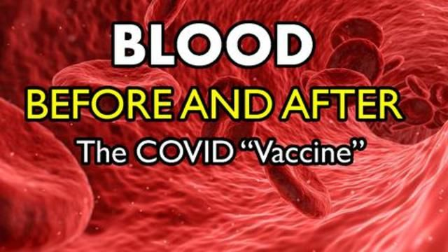 Vetted Images - Blood Before and After the mRNA COVID 