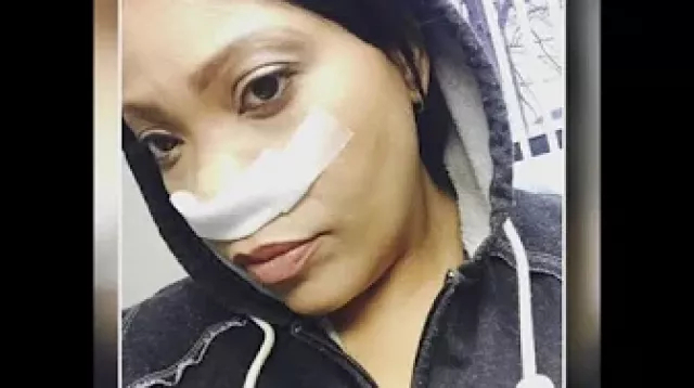 Sinus cancer survivor shares her battle - and how she found the illness