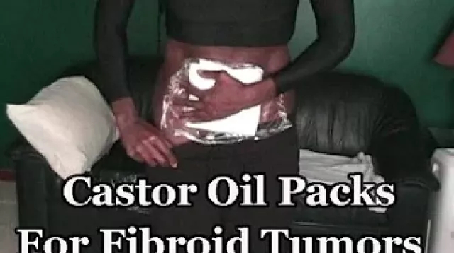 Castor Oil Packs For Fibroid Tumors (How to Video) - Dr. Akilah