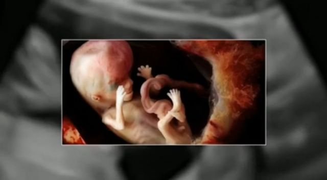 Babies have heart attacks in the womb from the jabs