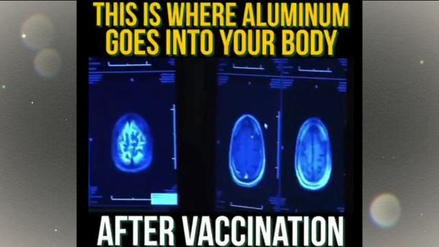 This is where Aluminum goes into your body after “vaccination”