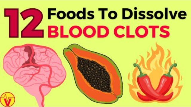 12 Foods That Dissolve Blood Clots Naturally (Doctors WON'T Tell You)