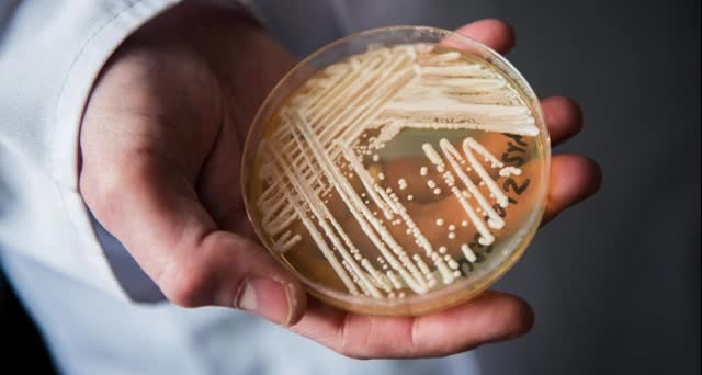 Deadly Fungus Outbreak - How Will Hospitals and Care Facilities Handle It