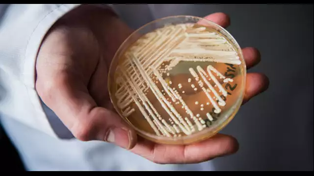 Deadly Fungus Outbreak - How Will Hospitals and Care Facilities Handle It