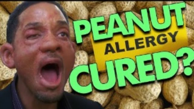 How I cured my Peanut Allergy in 6 weeks