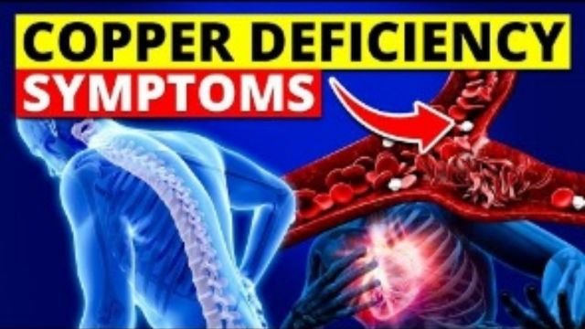 7 Signs and Symptoms of Copper Deficiency Disease!