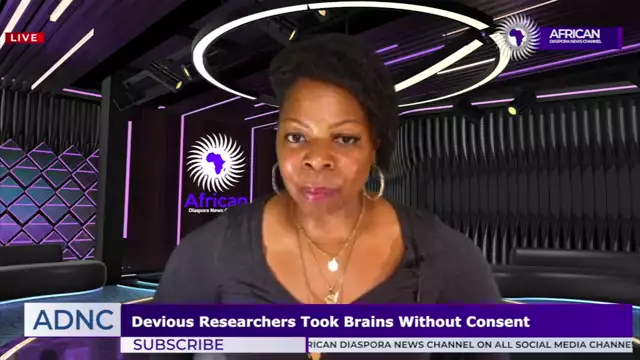 Brains Of Black People On Display At Smithsonian Taken Without Consent