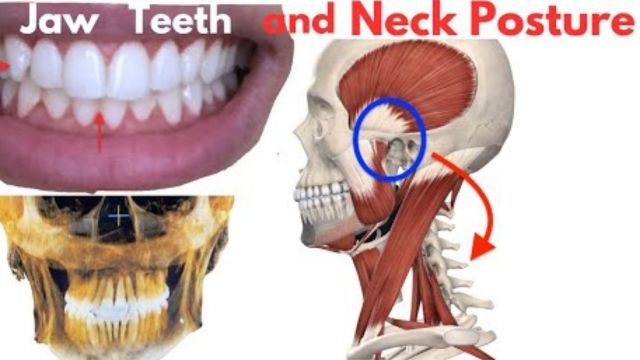 How Your Jaw and Teeth Influence Your Posture - What no one talks about!